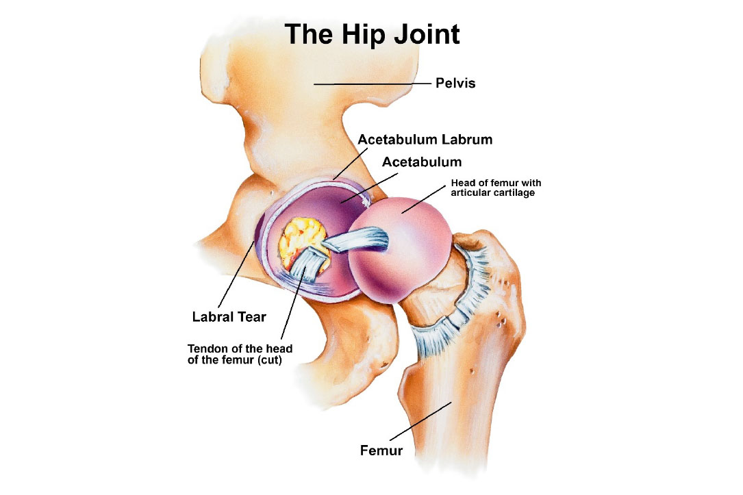 hip-joint