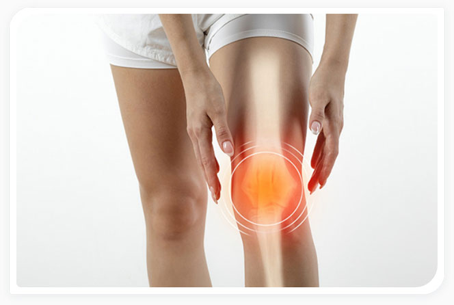 developing knee osteoarthritis