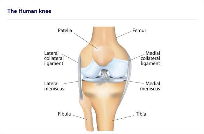 Different Kinds of Meniscus Tears