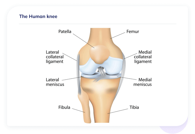 Different Kinds of Meniscus Tears