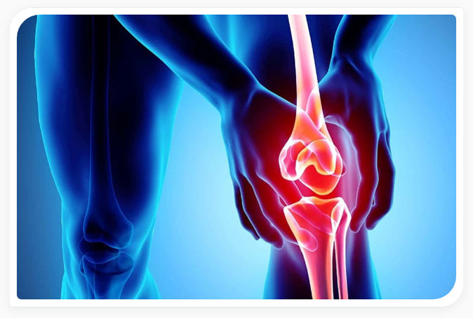 knee osteoarthritis diagnosed